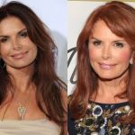 Roma Downey Plastic Surgery Before and After