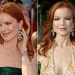 Marcia Cross Plastic Surgery Before and After