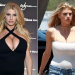Charlotte McKinney Plastic Surgery Before and After