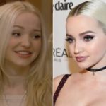 Dove Cameron Plastic Surgery Before and After