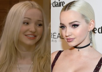 Dove Cameron Plastic Surgery Before And After Celebrity Surgeries