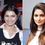 Prachi Desai Plastic Surgery Before and After