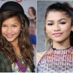 Zendaya Plastic Surgery Before and After