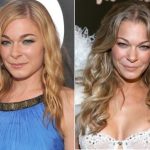 LeAnn Rimes Plastic Surgery Before and After