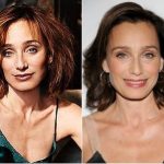 Kristin Scott Thomas Plastic Surgery Before and After