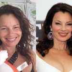 Fran Drescher Plastic Surgery Before and After