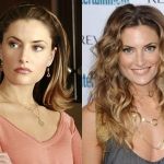 Mädchen Amick Plastic Surgery Before and After
