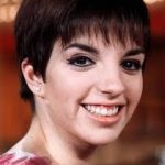 Liza Minnelli Plastic Surgery Before and After